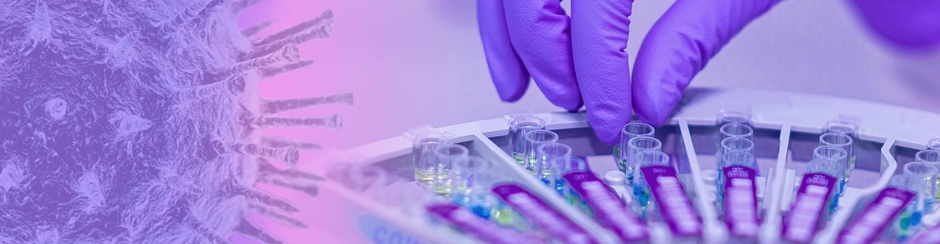 covid-19, coronavirus, epidemic, infection, exam, laboratory, medical, pathogen, corona-virus, laboratory, laboratory, laboratory, laboratory, laboratory